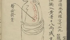 珍藏中医古籍：《医林精粹》