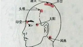 脱发有妙招：梳头与茯苓汤双管齐下，重焕秀发活力