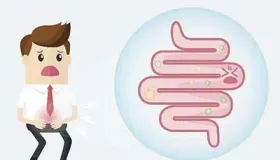 临床上大肠癌的中医综合治疗