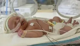 儿童口臭的原因是什么 如何解决？