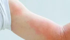 身体不适需避免进食以下食物
