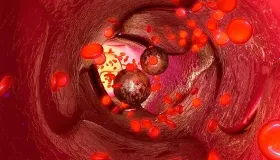 吃花生到底是可以保护血管，还是伤害血管？专家告诉你正确答案