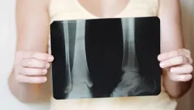 牛骨煲五指毛桃汤的功效与作用