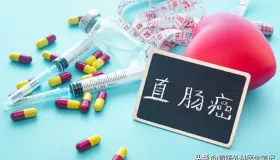 低位直肠癌手术方案全解析：医生的 “武器库” 里都有啥？