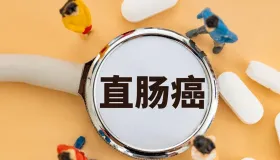 颠覆二十年指南！SCOT 研究最终结果出炉：结肠癌术后化疗，3 个月够了！