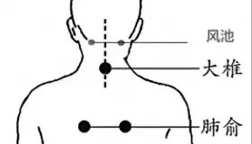 入伏了！中医专家教你“伏天”养生