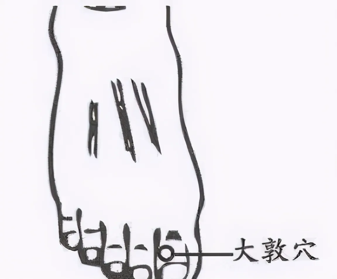 30 个超级有效穴位大集合：病症对应、取穴方法与按摩诀窍全知晓！插图29