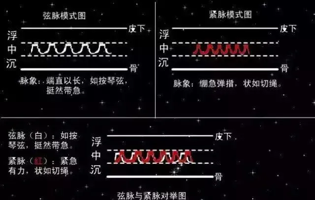 别再觉得中医把脉玄乎！一文读懂把脉原理及获取信息，解开你的困惑插图35