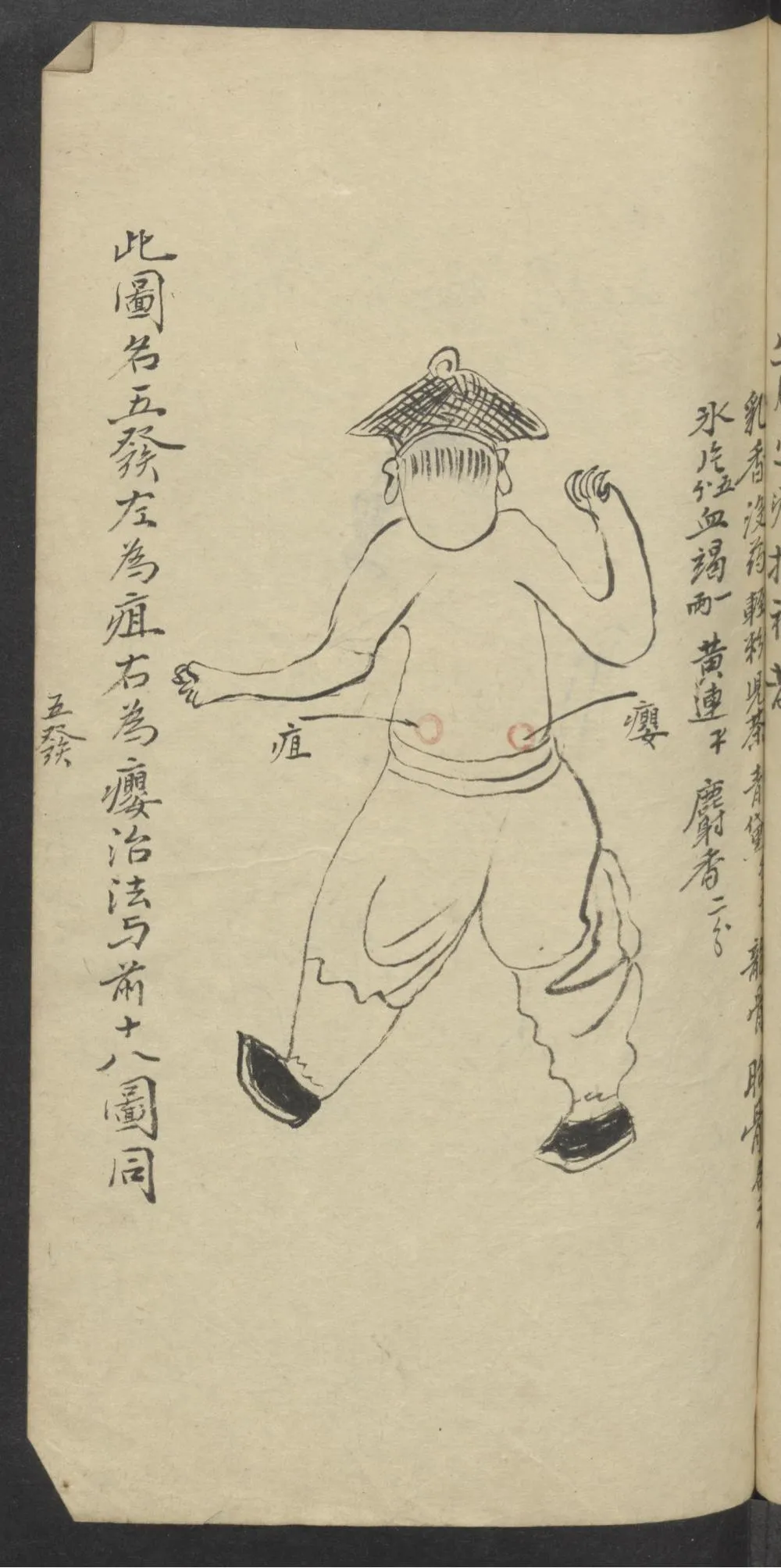 珍藏中医古籍：《医林精粹》插图25