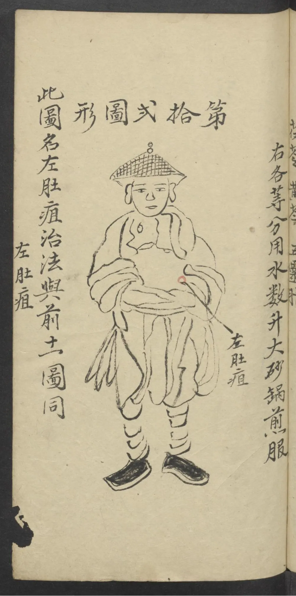 珍藏中医古籍：《医林精粹》插图11