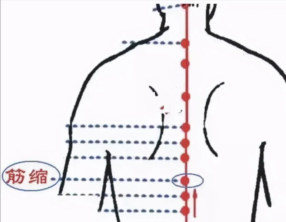 30 个超级有效穴位大集合：病症对应、取穴方法与按摩诀窍全知晓！插图17