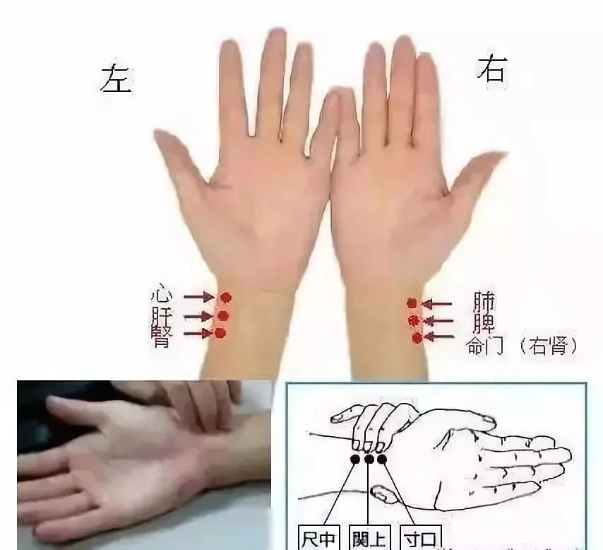 别再觉得中医把脉玄乎！一文读懂把脉原理及获取信息，解开你的困惑插图2