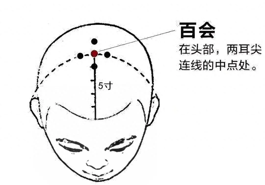 解锁百会穴神奇功效：防脱发、减头屑，从案例看如何巧用穴位改善脱发插图
