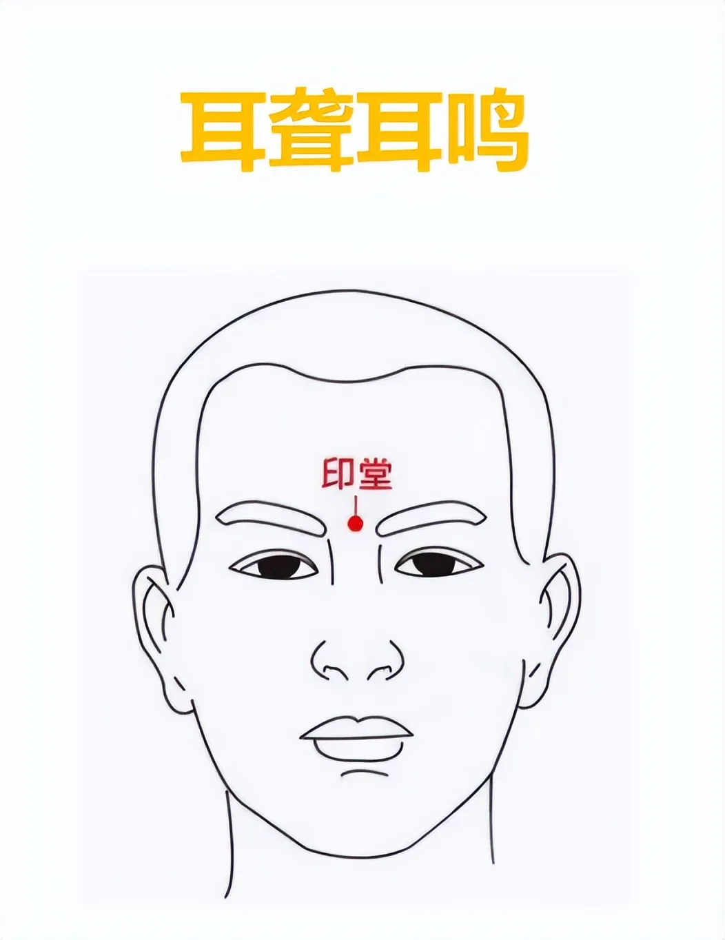 身体常见不适症状应对之穴位按摩秘籍，一文速查！插图10