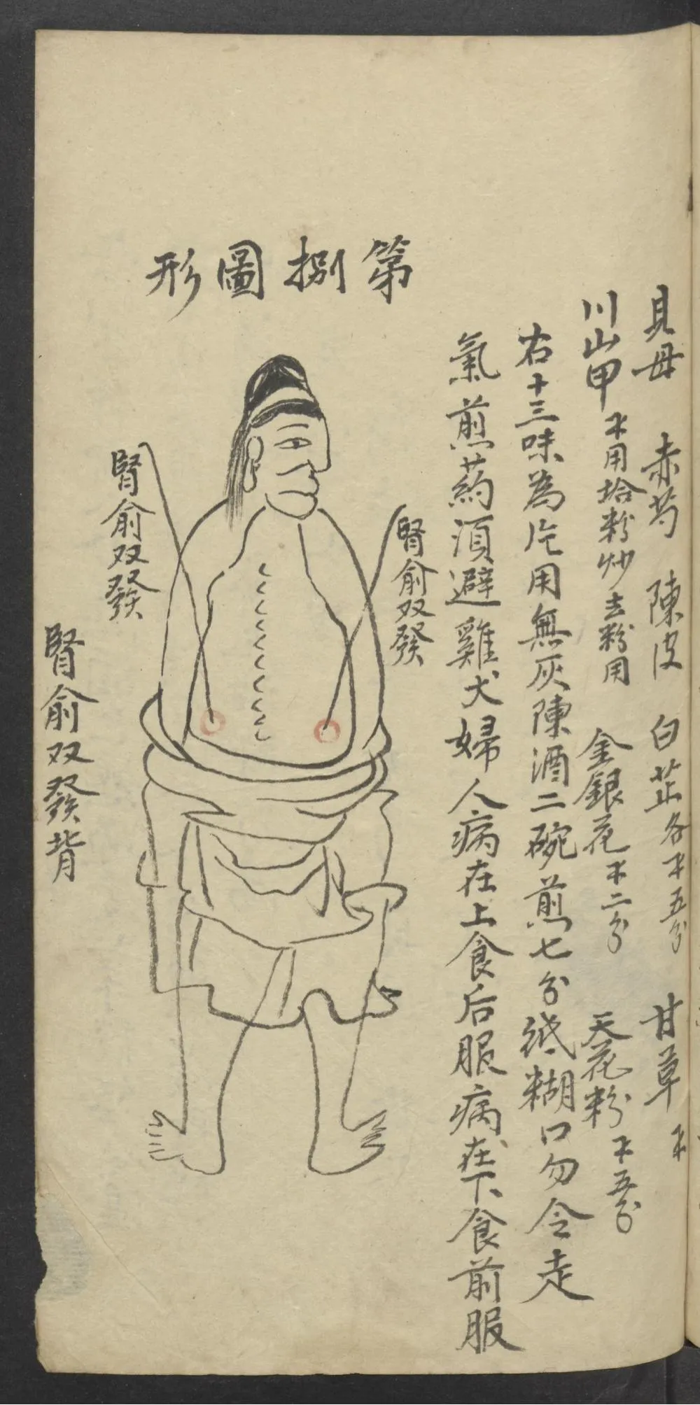 珍藏中医古籍：《医林精粹》插图3