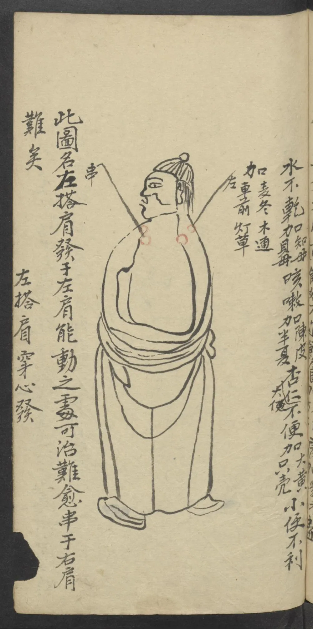 珍藏中医古籍：《医林精粹》插图7