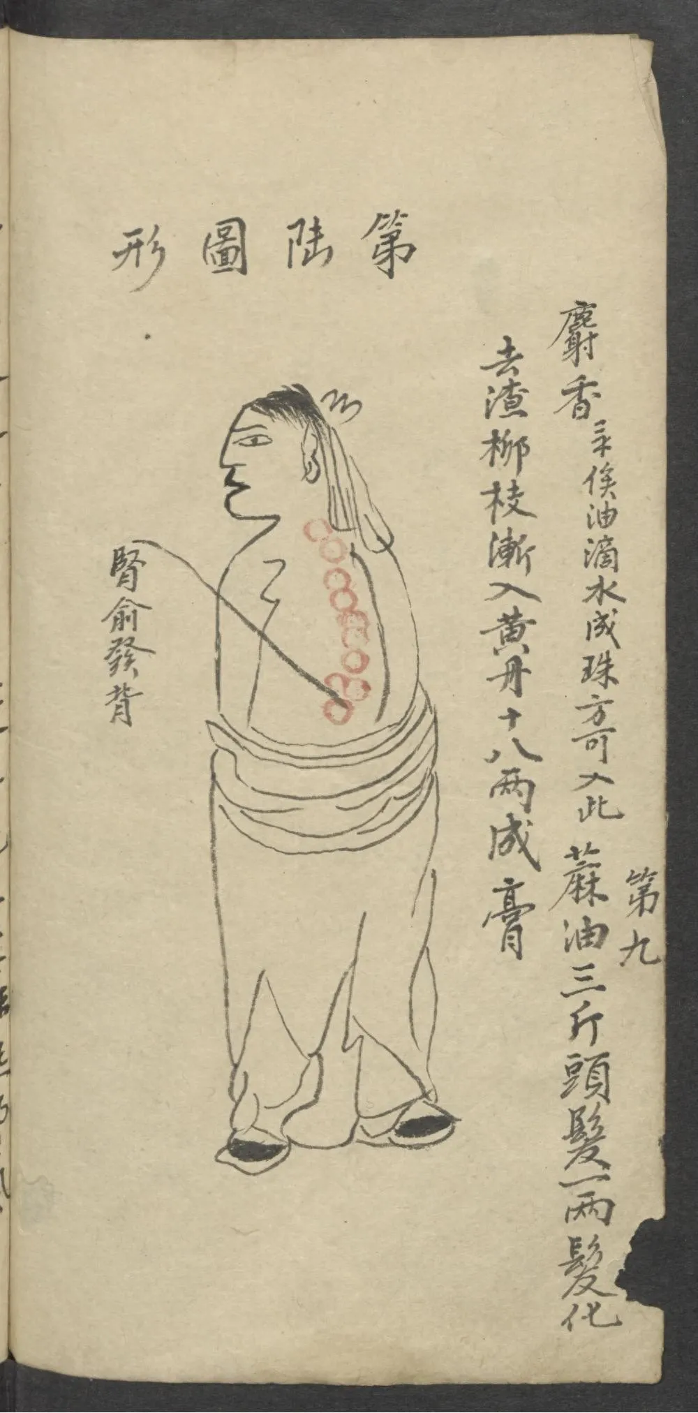 珍藏中医古籍：《医林精粹》插图