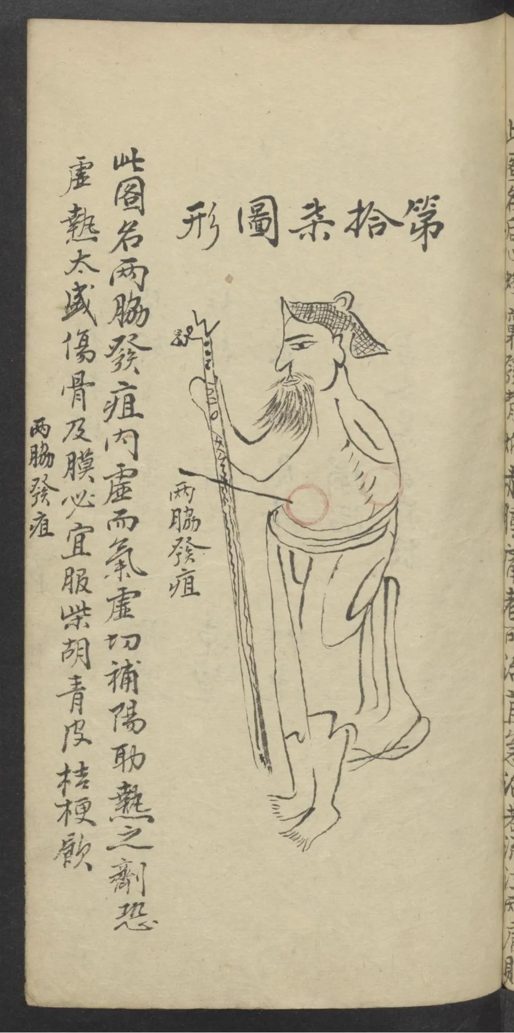 珍藏中医古籍：《医林精粹》插图21