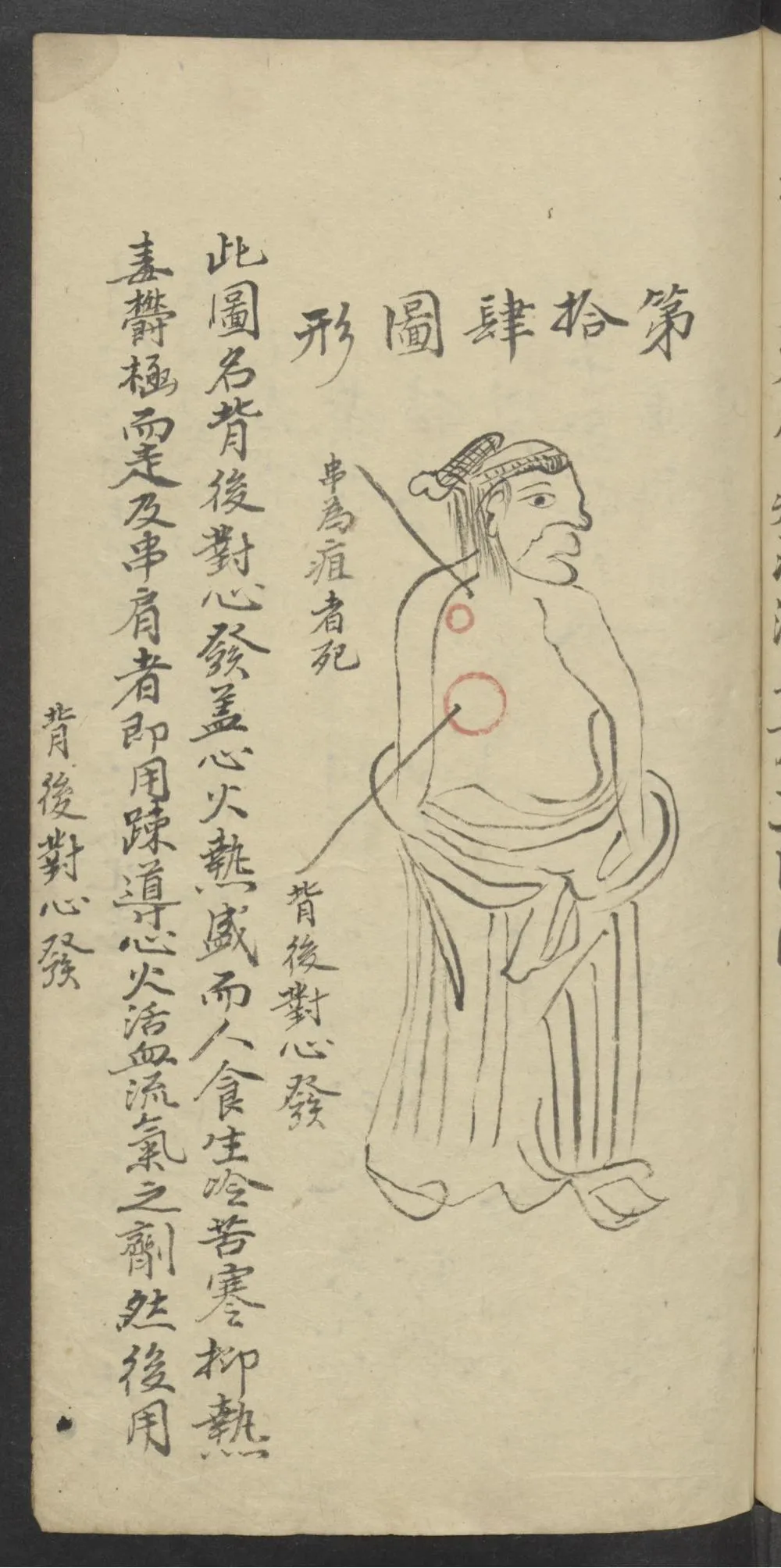 珍藏中医古籍：《医林精粹》插图13