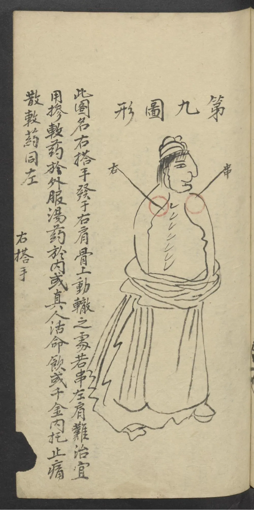 珍藏中医古籍：《医林精粹》插图5