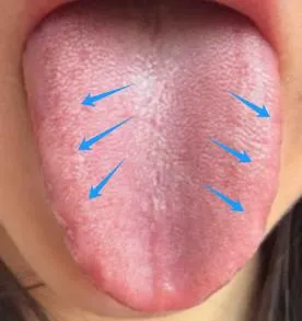 肝郁脾虚竟是脱发根源？三疗程妙方助你重焕浓密秀发插图1