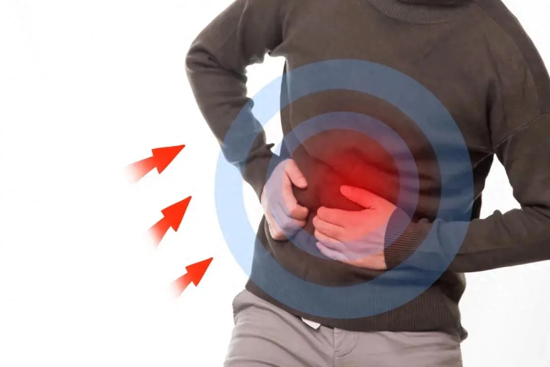 不开刀治阑尾炎！ERAT微创技术让他快速康复，还意外揪出肠道隐患插图