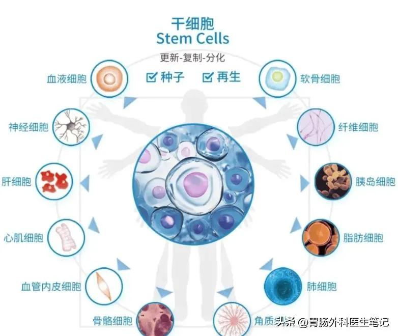 48 岁直肠癌肝转移、化疗耐药，他靠免疫细胞疗法重获新生插图3