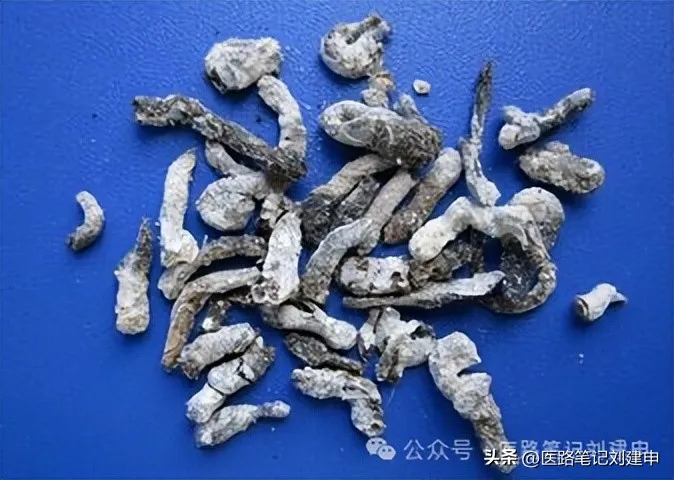 奇奇怪怪的中药——十个粪便药插图8