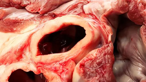 青春期吃肉少会怎么样插图1