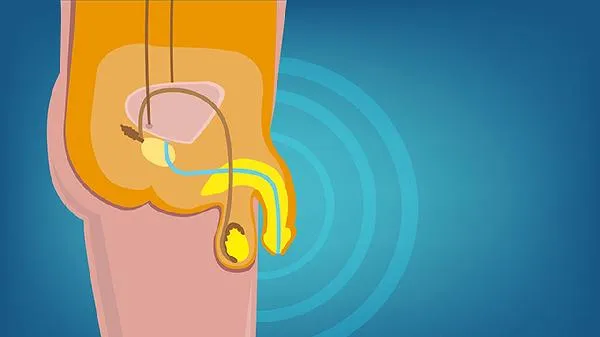 小心！食用猪睾丸的五大健康隐患你知道吗？插图