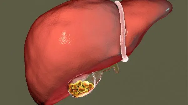 肝功能异常输什么氨基酸插图