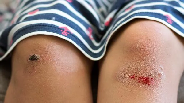 电梯没信号怎么求救插图1