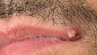 肱三头肌怎样训练 肱三头肌怎样训练？插图