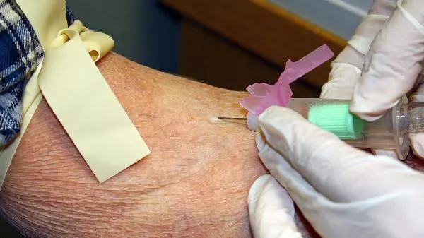 血脂高最忌讳吃什么食物插图2