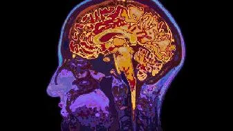 诱发脑肿瘤的原因是哪些   日常该做好哪些食疗插图1