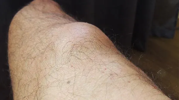 苦橙对皮肤的伤害插图1