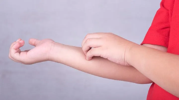 阿昔洛韦作用与功效有哪些插图1