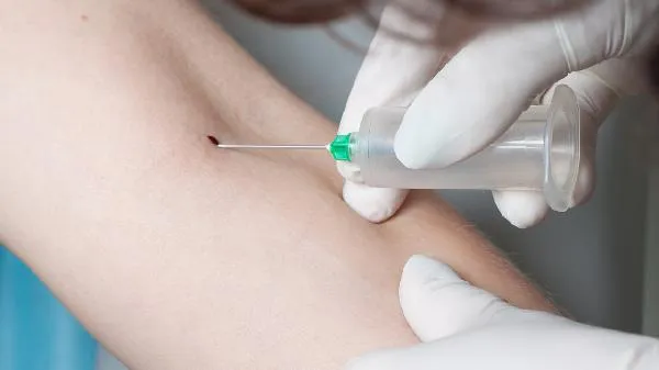 血脂高最忌讳吃什么食物插图