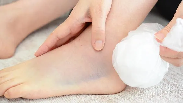 面部浮肿怎么办好呢插图