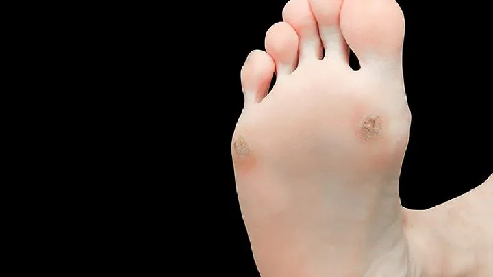 枸杞千万不能用开水泡插图