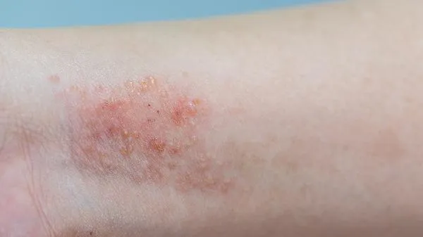 鲈鱼可以放冰箱冷冻吗 鲈鱼应该怎么保存插图