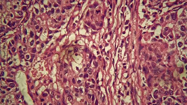 五价轮状病毒疫苗有必要打吗插图