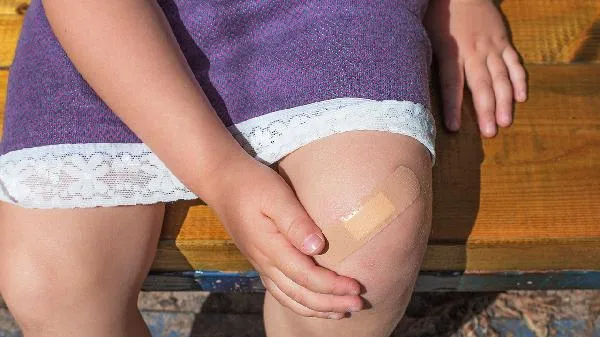 爬完楼梯小腿肿了会消下去吗插图