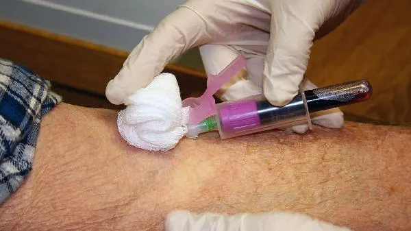 血脂高要忌什么食物插图