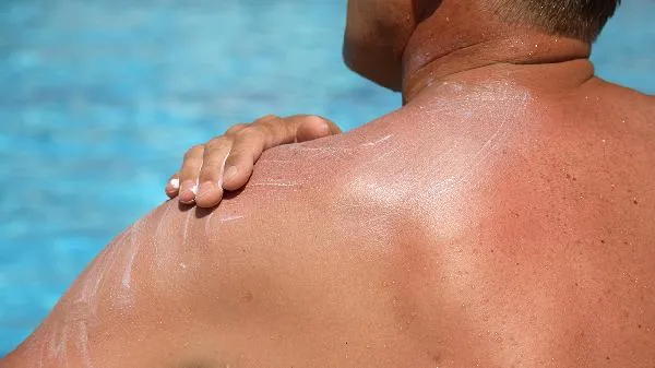 血糖高皮肤痒特征插图2