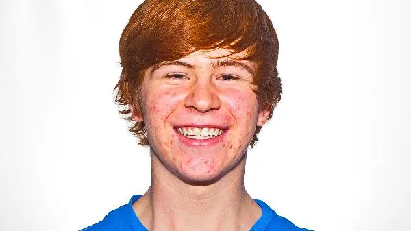 botox瘦脸针效果好吗插图 botox瘦脸针效果好吗插图