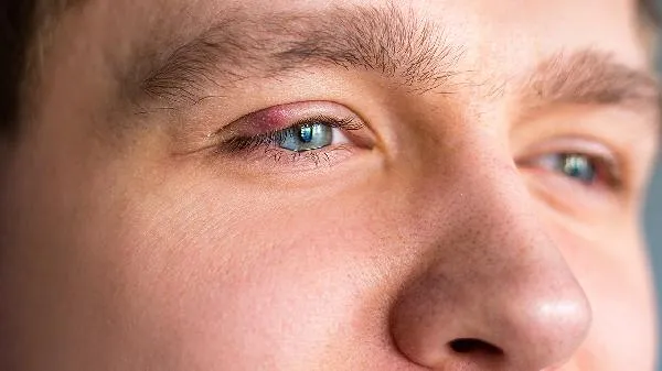 蓝莓什么时间吃吸收最好 一天吃多少蓝莓对眼睛好插图