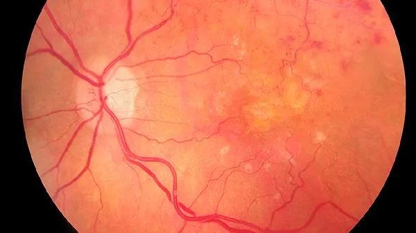 8种食物帮你疏通血管 8种食物改善血管堵塞插图1