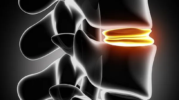 骨头伤了应该吃点什么补补插图1