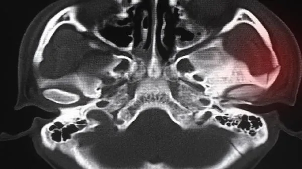 骨头受伤喝什么汤愈合比较快呢插图1